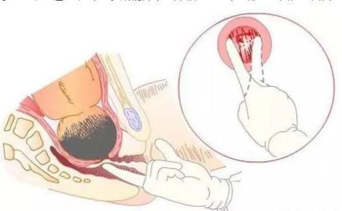 ʹǼӦעʲôǰӪӦòβ䣿